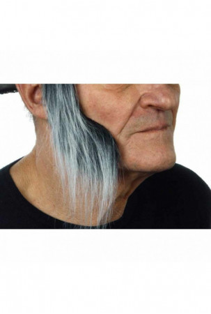 Netikri šoniniai nudegimai...