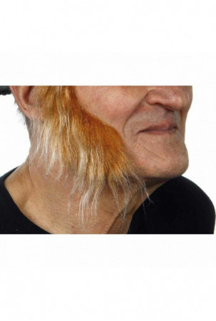 Netikri šoniniai nudegimai...