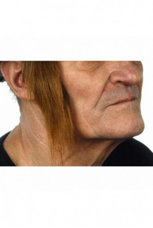 Netikri šoniniai nudegimai...